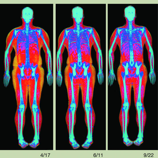 Three multi-colored medical scans of a human body, emphasizing bones and flesh
