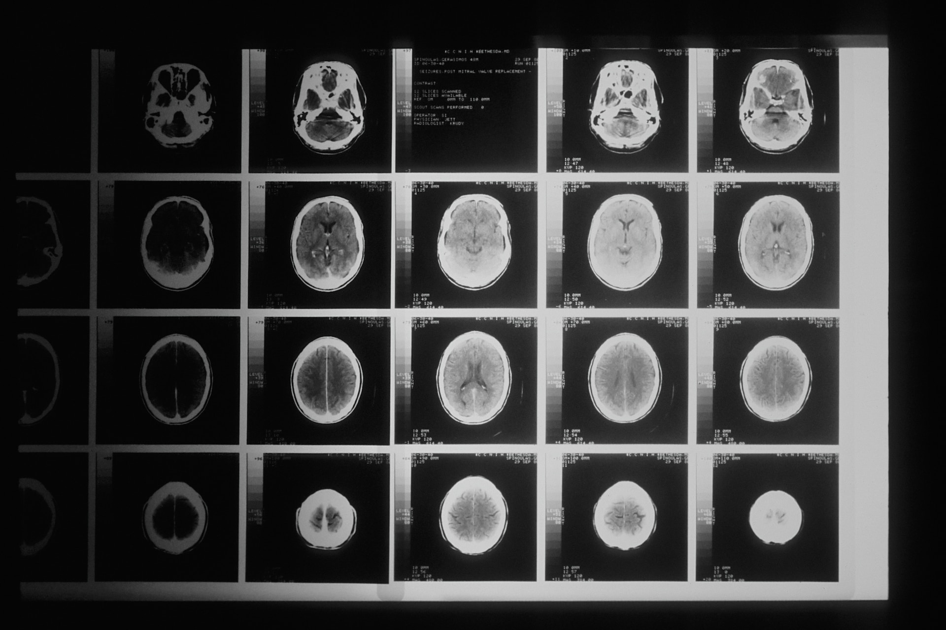 A grid of MRI scans of a human head.